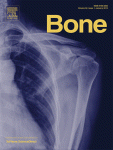 2013-Bone.gif