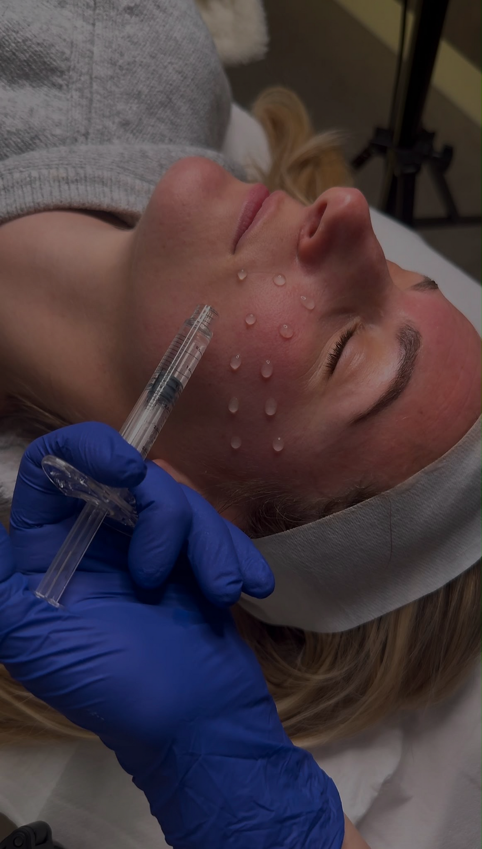 Advanced Skin Boosters being performed by Laura