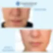 3 x Treatments