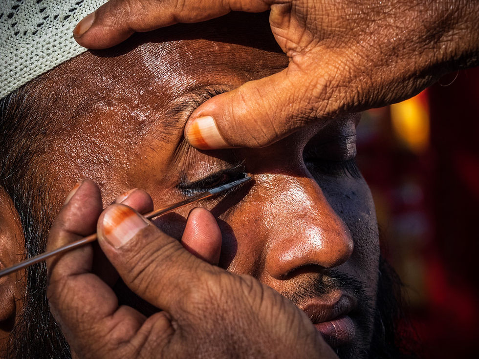 Bangladesh. Day 3 - Trump! And Sticking Needles in your Eyes.