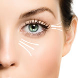 Anti-wrinkle-treatment-auckland