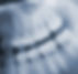 dental-xray-west-auckland-dentist