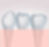 Dental-bridge-west-auckland-dentist