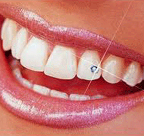 tooth-jewelery-auckland-dentist