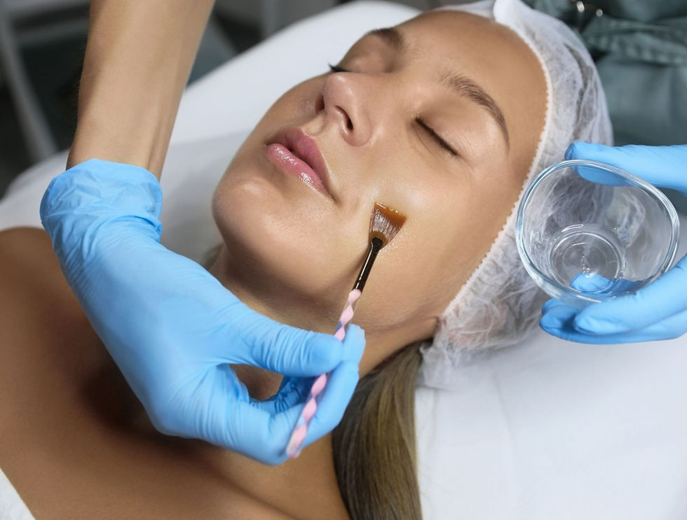 CHEMICAL PEEL