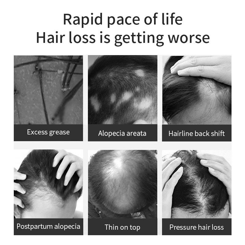 Thumbnail: LSR-BIOTIN HAIR LOSS SERUM