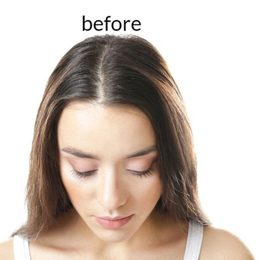 Thumbnail: LSR MINOXIDIL  FOR WOMEN 2%