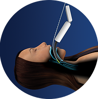 Bougie_Catheter_circle_2_010.png