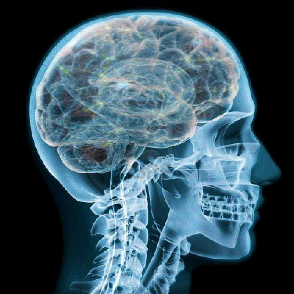 xray2.gif