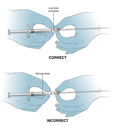 Two side-by-side flat color illustrations of blue surgical-gloved hands demonstrating correct and incorrect needle and syringe assembly. The correct demonstration shows the hands holding the luer-lock connector, and the incorrect demonstration shows the hands gripping the syringe body.