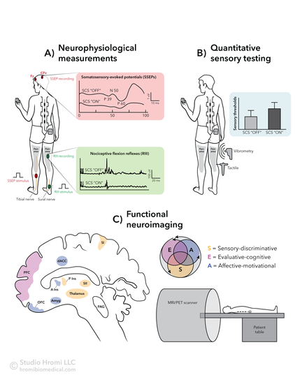 An infographic depicting methods of spinal cord stimulation testing and imaging. Included are simple illustrations of human forms, a brain, and a person in an MRI machine.