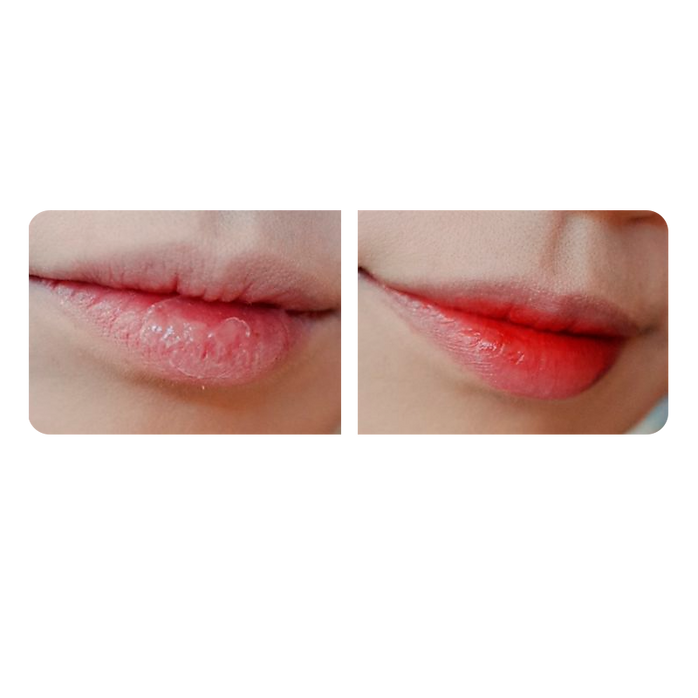 Miniatura: Bálsamo labial Frudia Blueberry Hydrating Honey Lip Balm para skincare coreano en Perú