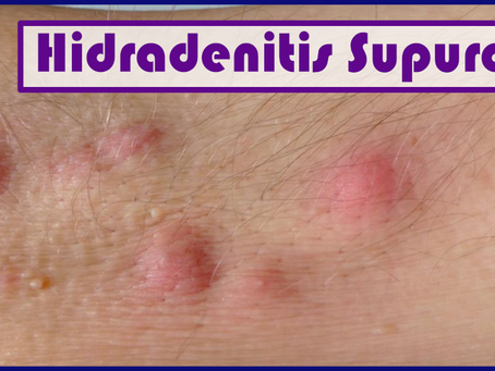 Hidradenitis supurativa