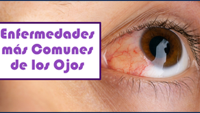 Enfermedades más Comunes de los Ojos