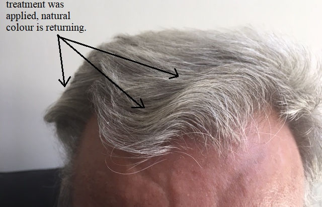 TNI's Hair Growth Enhancer Trials and Results