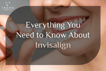 Everything You Need to Know About Invisalign