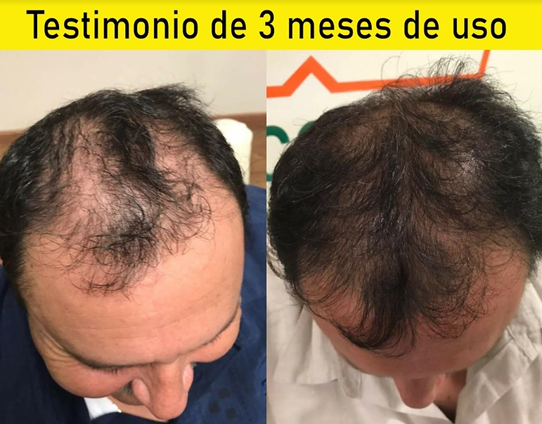 Tonico Capilar 5..png