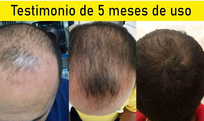 Tonico Capilar 4..png