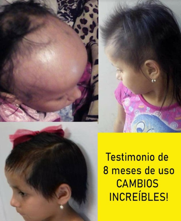 Tonico Capilar 2..png