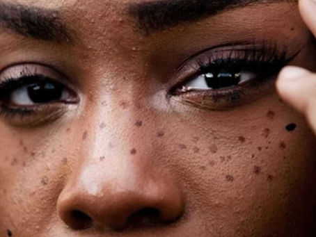 A nova moda é tatuar sardas em forma de constelações dos signos