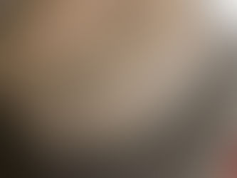 Transgêneros podem optar por implantes em alternativa aos hormônios