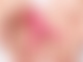 Câncer de mama: risco é maior durante tratamento para engravidar