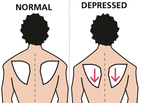 Depressed Scapulae