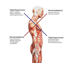 Joint Pain: Structure vs Function