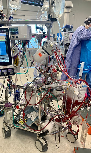 Cardiopulmonary bypass