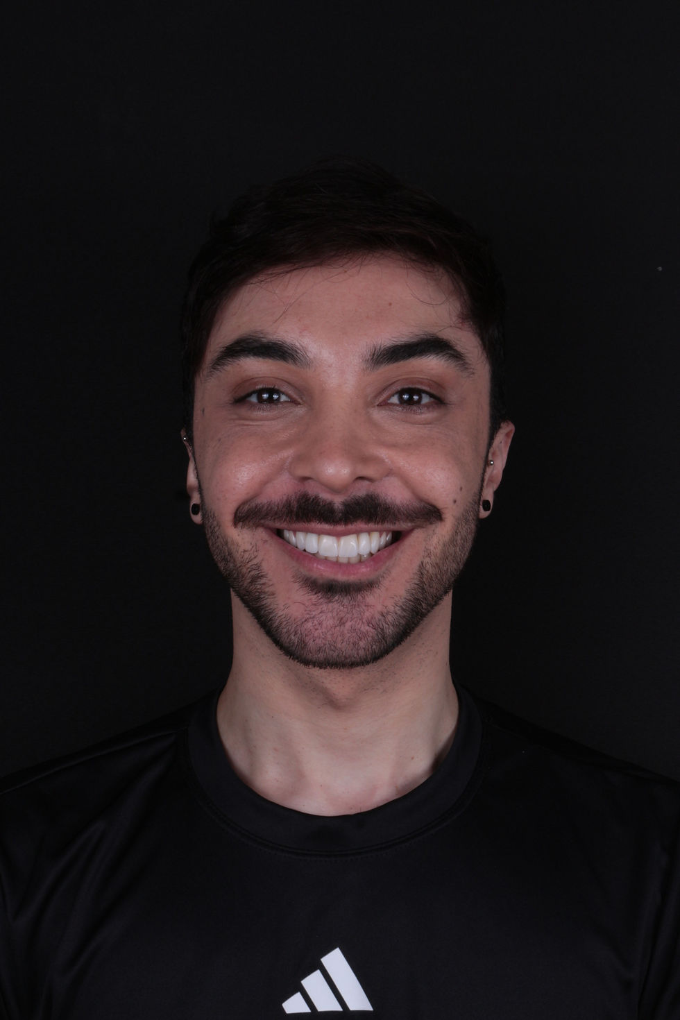 Depois - Próteses Faciais de Polietileo Poroso - Dr. Samir Murador