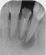 Oralchirurgie