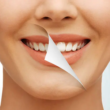 Debunking Common Teeth Whitening Myths