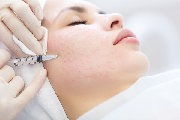 Mesotherapy_d1450.jpeg