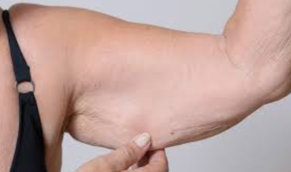 Vieillir et garder ses muscles