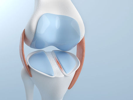 Meniscus Tears That Cause Locking Without Swelling