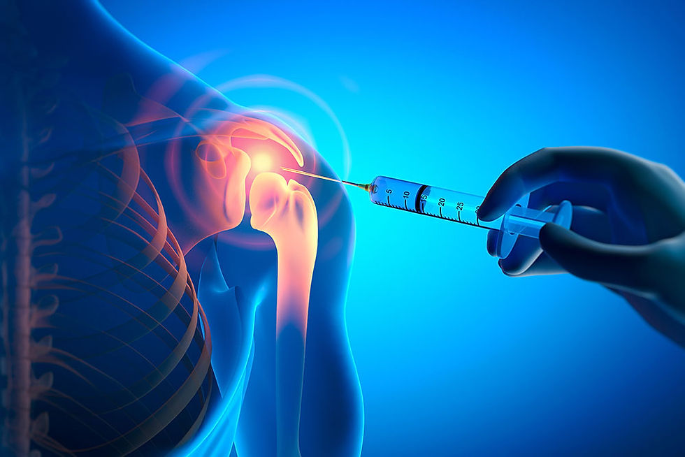 Cortisone Injections in the Shoulder: Benefits and Risks Over Time