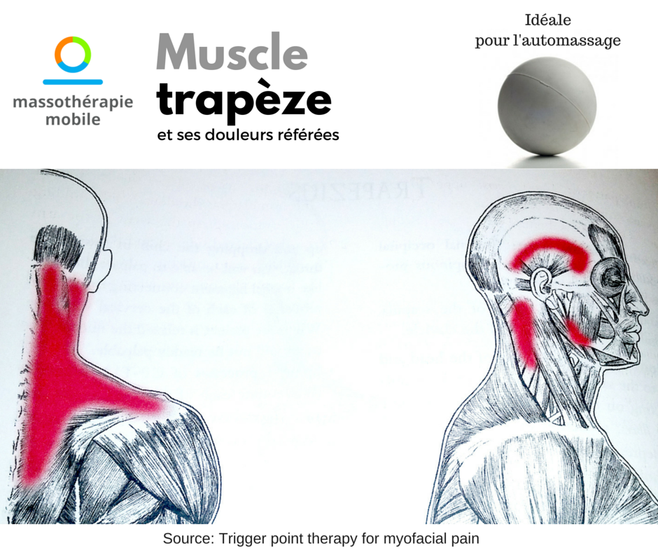 Muscle trapèze et ses douleurs référées