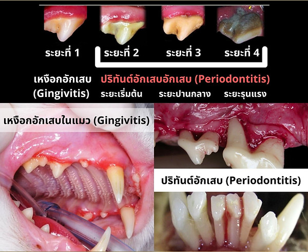 periodontitis.jpeg