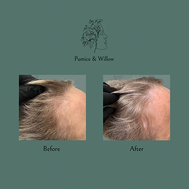 Untitled design(2).png