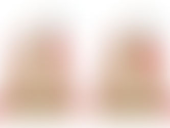 Learn the symptoms, causes, and treatment options for periodontal (gum) disease from Dr. Alexander Lezhansky