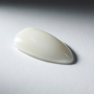 Porcelain Veneer Smile Design