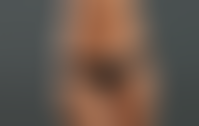 Smart Lipo - The Facts