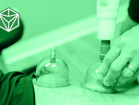 Exploring the Ancient Art of Cupping Therapy: Benefits and Insights