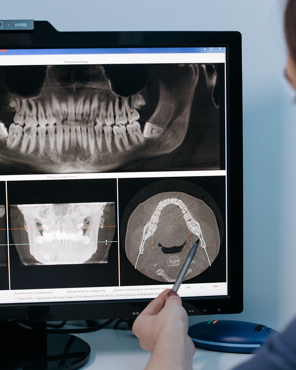 Dental professional analyses detailed X-ray images showing teeth alignment and bone structure on a computer monitor.