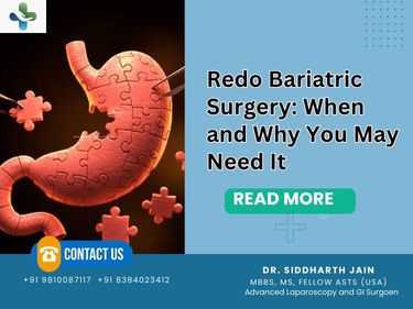 Redo Bariatric Surgery