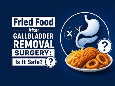 Can You Eat Fried Food After Gallbladder Removal Surgery?
