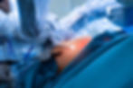 Laparoscopy