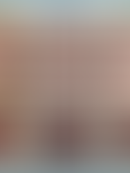 有嚴重牙周病,可以矯正嗎?