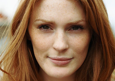 Carbondioxide laser resurfacing, Smartxide, laser facelift, nonsurgical facelifft
