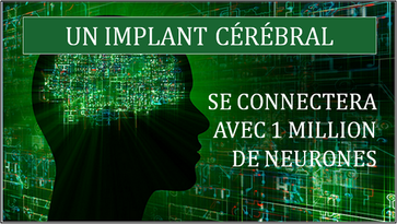 UN IMPLANT CÉRÉBRAL SE CONNECTERA AVEC 1 MILLION DE NEURONES